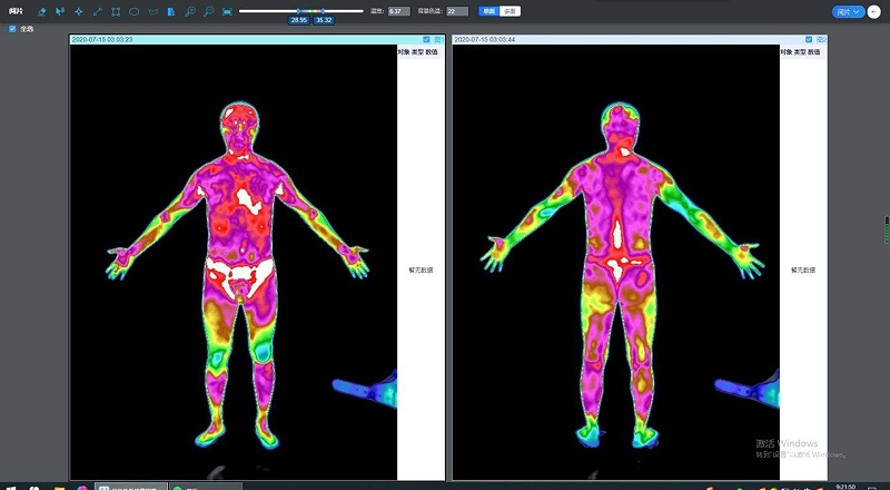 疫情環(huán)境下，為什么紅外熱成像產(chǎn)品要比額溫槍有效率？